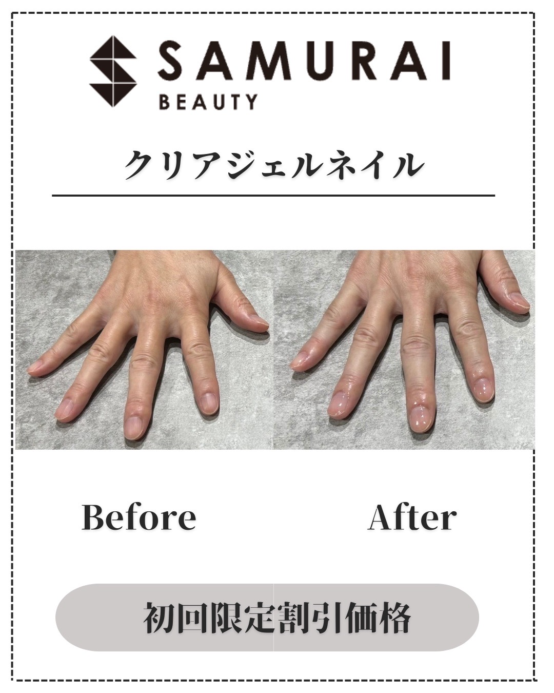 クリアジェルネイル Before/After